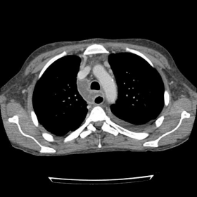 Axial contrast-enhanced CT scan
