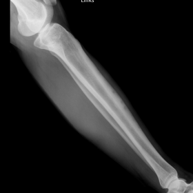 Conventional Radiographs: Tibia 2007