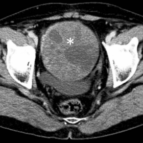 Axial contrast-enhanced CT image