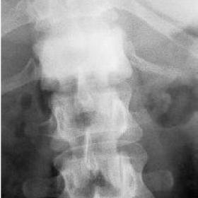 Conventional radiograph