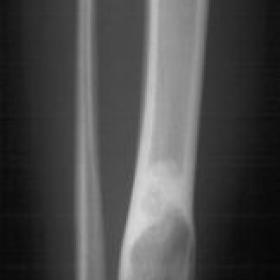 X-Ray, conventional