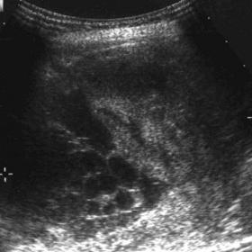 Ultrasonography of the upper abdomen