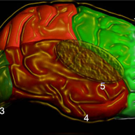 Fig 1a: a draw of  the hemisphere’s lateral face. 1: frontal lobe; 2: parietal lobe; 3: occipital lobe; 4: temporal lobe; 5: insula lobe. (4)