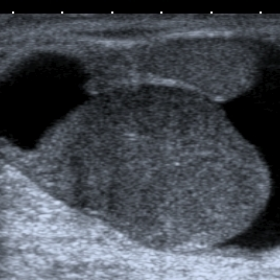Grayscale ultrasound