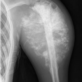 Left arm X-ray