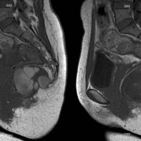 Sagittal T1-weighted MR images