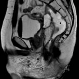 Unenhanced and post-contrast MRI