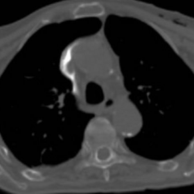 Urgent multidetector CT - Unenhanced and 3D-VR images