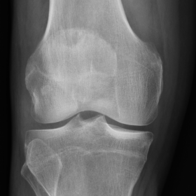 Radiography of the knee.