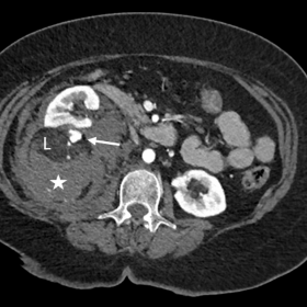 Axial contrast-enhanced computed tomography