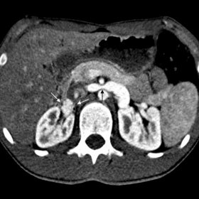 Axial contrast-enhanced CT image