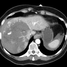 Contrast-enhanced CT, axial view.