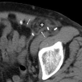 Unenhanced and contrast-enhanced multidetector CT