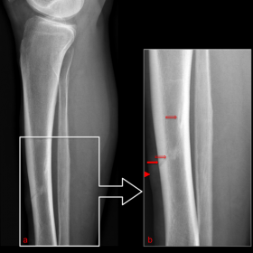 Conventional Radiography - Lateral View