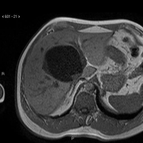 Axial T1-weighted image