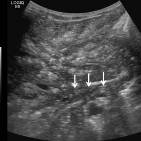 Initial abdominal ultrasonography