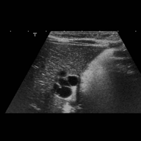Preprandial ultrasound