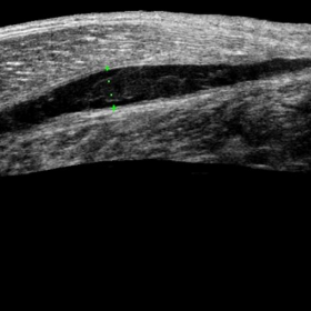 Initial evaluation with EFOV ultrasound