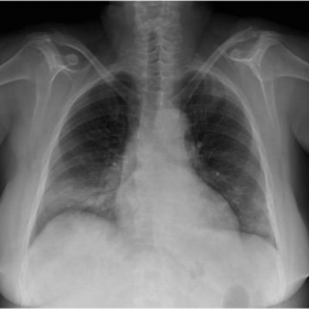 Conventional chest radiography.