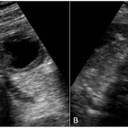 Abdominal ultrasonography scans in axial (a) and longitudinal planes (b).